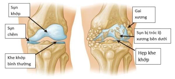 Kiểm tra công tác phòng, chống dịch Covid - 19 tại Trạm Y tế xã, phường.