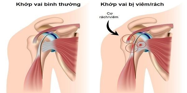 Đồng chí Nguyễn Thế Phước - Phó Chủ tịch Thường trực UBND tỉnh thăm và tặng quà tết Trung tâm Y tế thành phố Yên Bái.