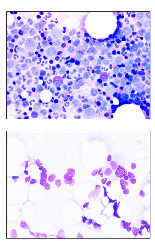 Hình ảnh tin tức Các đơn vị Y tế trên địa bàn hỗ trợ kịp thời Trung tâm Y tế thành phố Yên Bái thực hiện nhiệm vụ phòng chống Covid - 19