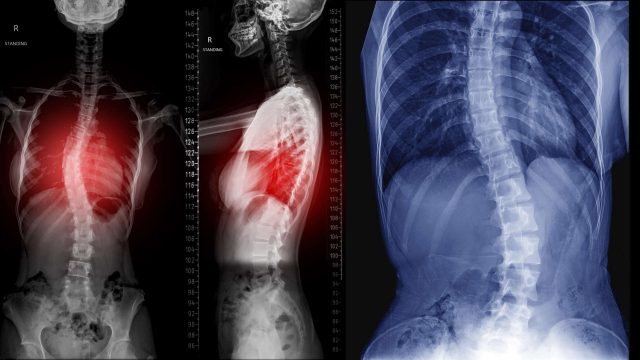 Hình ảnh tin tức Lần đầu tiên trong 1 tháng qua, tròn 24h không ghi nhận ca mắc mới COVID-19