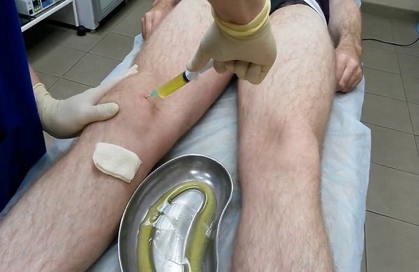 Hình ảnh tin tức Trung tâm Y tế thành phố Yên Bái tổ chức họp Hội đồng người bệnh cấp bệnh viện năm 2020