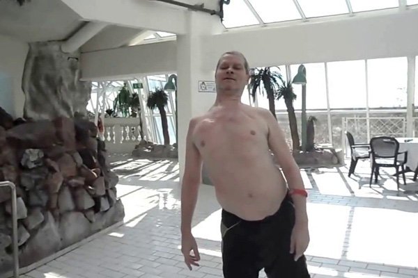 Hình ảnh tin tức Khám sàng lọc cho trẻ em khuyết tật trên địa bàn thành phố Yên Bái