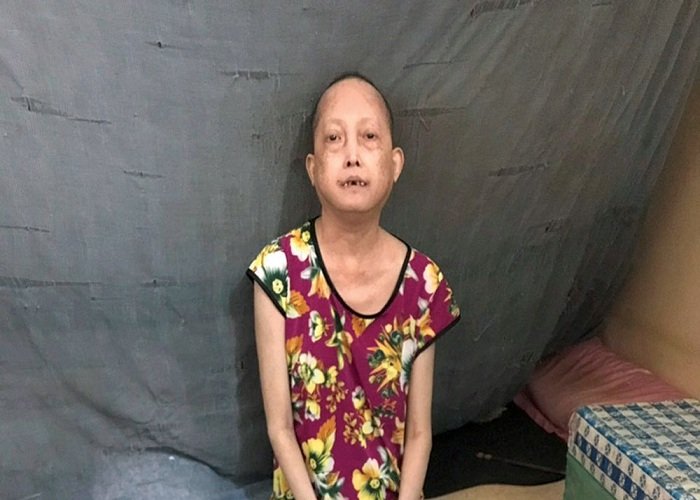 Hình ảnh tin tức Trung tâm Y tế thành phố Yên Bái phối hợp với bệnh xá Công an tỉnh Yên Bái tổ chức triển khai khám sức khỏe định kỳ