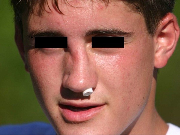 Trung tâm Y tế thành phố tổng kết công tác Y tế năm 2017- triển khai phương hướng, nhiệm vụ năm 2018