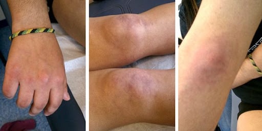 Hình ảnh tin tức Chi hội thầy thuốc trẻ Trung tâm Y tế thành phố Yên Bái tổ chức các hoạt động  kỷ niệm 73 năm Ngày Thương binh – Liệt sĩ.