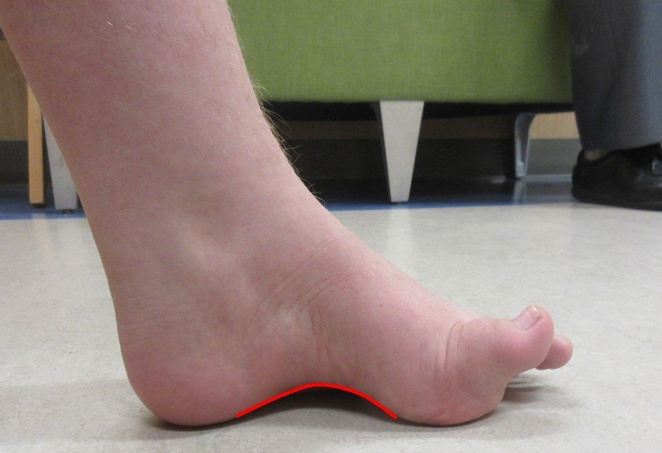 Hình ảnh tin tức Nguy cơ từ thói quen đốt than tổ ong, đốt than củi để sưởi ấm