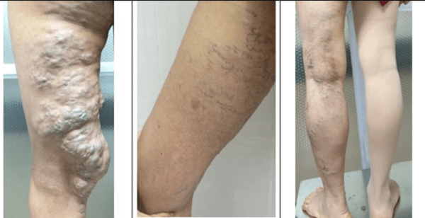 9 loại thuốc và 6 thiết bị F0 cần chuẩn bị để cách ly, điều trị tại nhà