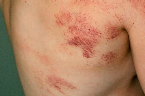 9 biện pháp mới nhất phòng chống dịch COVID-19 người dân cần biết