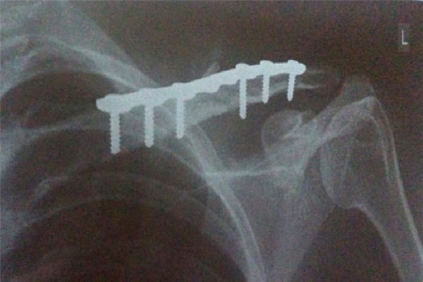 Hình ảnh tin tức Tập huấn về một số rối loạn tâm thần thường gặp tại cộng đồng